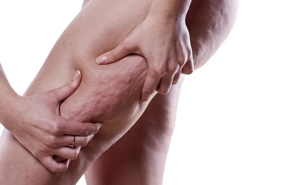 Ma Cellulite Se Voit, Et Alors? - YOPHIY CURVES